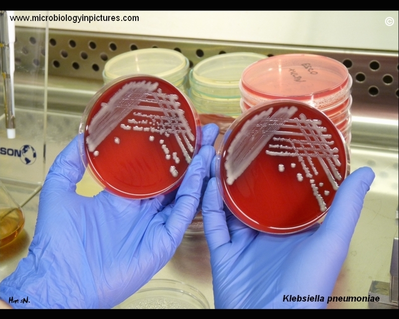 strains of K.pneumoniae